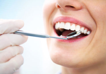 Teeth-Checkup-370x260 milpitas cosmetic dentist